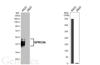 Anti-GPRC5A antibody [HL3393] used in Western Blot (WB). GTX641213