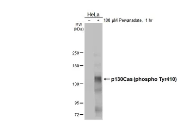 Anti-p130Cas (phospho Tyr410) antibody [HL3401] used in Western Blot (WB). GTX641238