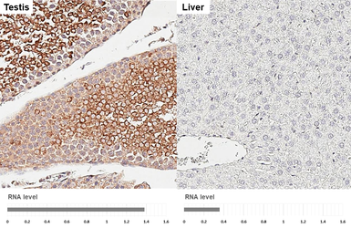 Anti-HDAC4 antibody [HL3420] used in IHC (Paraffin sections) (IHC-P). GTX641262