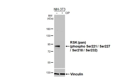 Anti-RSK (pan) (phospho Ser221 / Ser227 / Ser218 / Ser232) antibody [HL3427] used in Western Blot (WB). GTX641269
