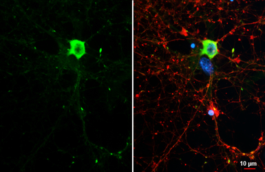 Anti-WAVE1 antibody [HL3446] used in Immunocytochemistry/ Immunofluorescence (ICC/IF). GTX641319