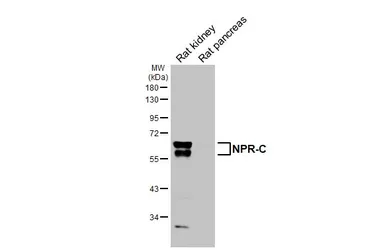 Anti-NPR-C antibody [HL3462] used in Western Blot (WB). GTX641347