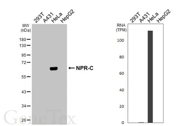 Anti-NPR-C antibody [HL3462] used in Western Blot (WB). GTX641347