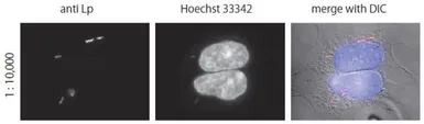 Anti-Legionella pneumophila antibody used in Immunocytochemistry/ Immunofluorescence (ICC/IF). GTX64135