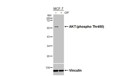 Anti-AKT (phospho Thr450) antibody [HL3478] used in Western Blot (WB). GTX641363