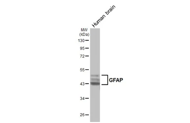 Anti-GFAP antibody [GT51] used in Western Blot (WB). GTX641375