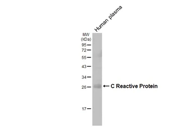 Anti-C Reactive Protein antibody [GT55] used in Western Blot (WB). GTX641407