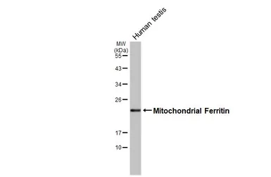 Anti-Mitochondrial Ferritin antibody [HL3521] used in Western Blot (WB). GTX641418