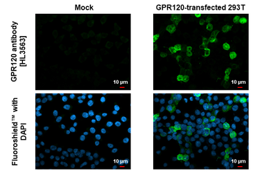 Anti-GPR120 antibody [HL3563] used in Immunocytochemistry/ Immunofluorescence (ICC/IF). GTX641469