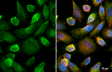 Anti-beta 2 Adrenergic Receptor antibody [HL3594] used in Immunocytochemistry/ Immunofluorescence (ICC/IF). GTX641565