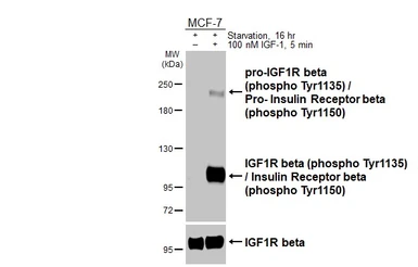 Anti-IGF1R beta (phospho Tyr1135) / Insulin Receptor beta (phospho Tyr1150) antibody [HL3614] used in Western Blot (WB). GTX641589