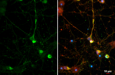 Anti-Neuroligin 3 antibody [GT65] used in Immunocytochemistry/ Immunofluorescence (ICC/IF). GTX641603