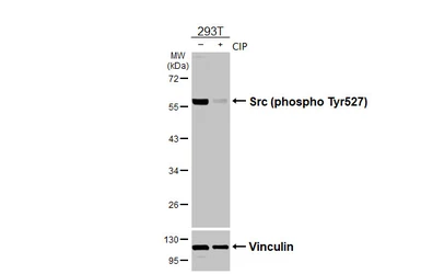 Anti-Src (phospho Tyr530) antibody [HL3645] used in Western Blot (WB). GTX641636
