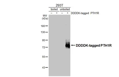 Anti-PTH1R antibody [HL3651] used in Western Blot (WB). GTX641642