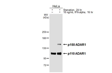 Anti-ADAR1 antibody [HL3666] used in Western Blot (WB). GTX641694