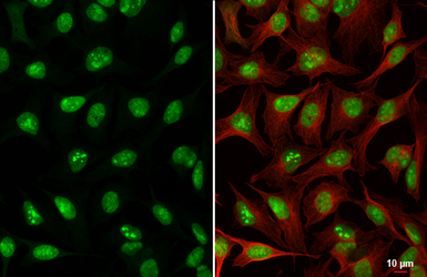 Anti-ADAR1 antibody [HL3666] used in Immunocytochemistry/ Immunofluorescence (ICC/IF). GTX641694