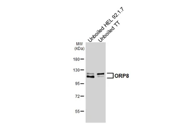 Anti-ORP8 antibody [HL3674] used in Western Blot (WB). GTX641702