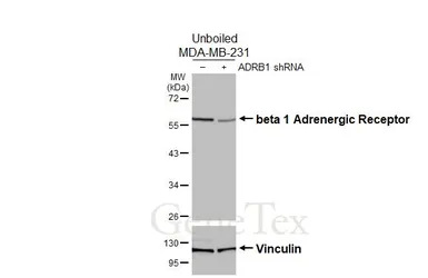 Anti-beta 1 Adrenergic Receptor antibody [HL3678] used in Western Blot (WB). GTX641706