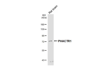 Anti-PHACTR1 antibody [HL3726] used in Western Blot (WB). GTX641916