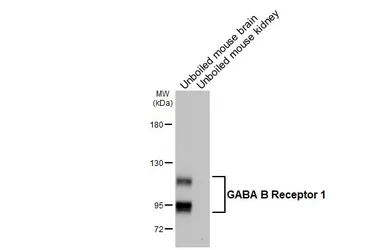 Anti-GABA B Receptor 1 antibody [GT83] used in Western Blot (WB). GTX641938