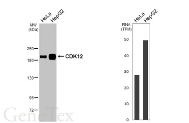 Anti-CDK12 antibody [HL3757] used in Western Blot (WB). GTX641956