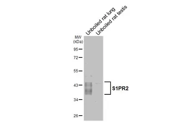 Anti-S1PR2 antibody [HL3765] used in Western Blot (WB). GTX641964