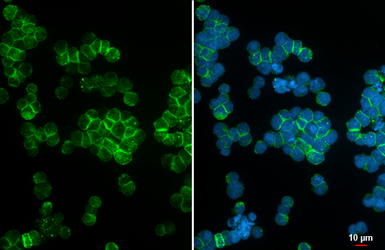 Anti-CXCR5 antibody [HL3777] used in Immunocytochemistry/ Immunofluorescence (ICC/IF). GTX641976