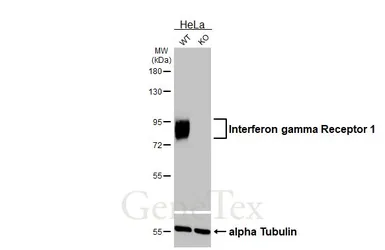 Anti-Interferon gamma Receptor 1 antibody [HL3811] used in Western Blot (WB). GTX642035