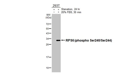 Anti-RPS6 (phospho Ser240/Ser244) antibody [HL3824] used in Western Blot (WB). GTX642048