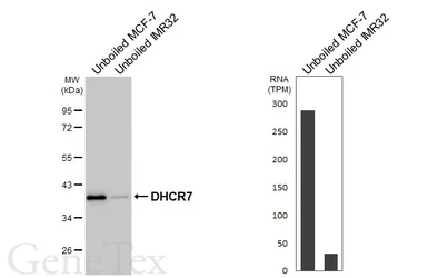 Anti-DHCR7 antibody [HL3854] used in Western Blot (WB). GTX642088