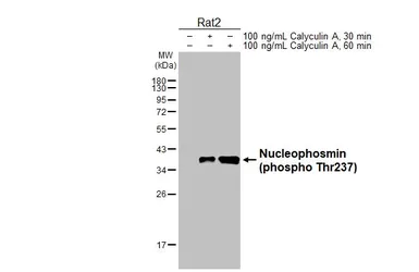 Anti-Nucleophosmin (phospho Thr237) antibody [HL3855] used in Western Blot (WB). GTX642089