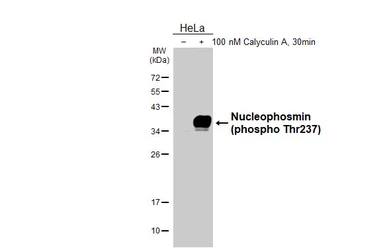 Anti-Nucleophosmin (phospho Thr237) antibody [HL3855] used in Western Blot (WB). GTX642089