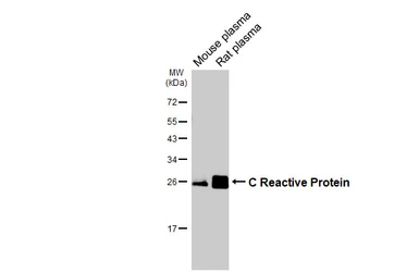 Anti-C Reactive Protein antibody [HL3867] used in Western Blot (WB). GTX642105