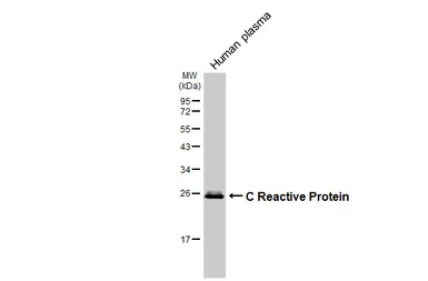 Anti-C Reactive Protein antibody [HL3867] used in Western Blot (WB). GTX642105