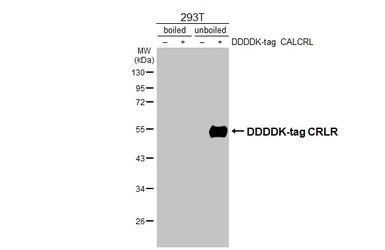 Anti-CRLR antibody [HL3876] used in Western Blot (WB). GTX642114