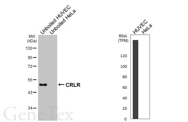 Anti-CRLR antibody [HL3876] used in Western Blot (WB). GTX642114
