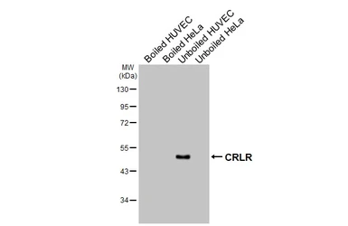 Anti-CRLR antibody [HL3876] used in Western Blot (WB). GTX642114