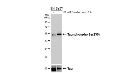 Anti-Tau (phospho Ser235) antibody [HL3899] used in Western Blot (WB). GTX642140