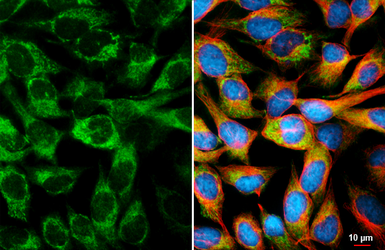 Anti-GIT1 antibody [GT104] used in Immunocytochemistry/ Immunofluorescence (ICC/IF). GTX642152