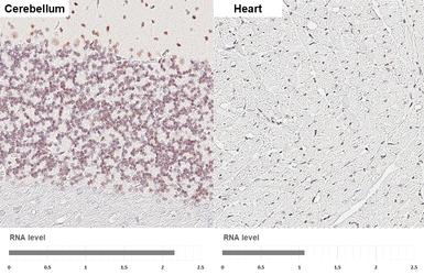 Anti-Ataxin 1 antibody [GT106] used in IHC (Paraffin sections) (IHC-P). GTX642154