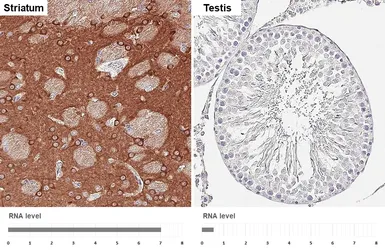 Anti-PHACTR1 antibody [HL3954] used in IHC (Paraffin sections) (IHC-P). GTX642204