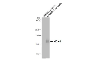 Anti-HCN4 antibody [GT112] used in Western Blot (WB). GTX642220