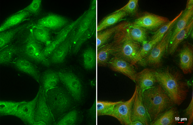 Anti-Adenosine A1 Receptor antibody [HL3987] used in Immunocytochemistry/ Immunofluorescence (ICC/IF). GTX642313