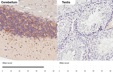 Anti-Brevican antibody [GT123] used in IHC (Paraffin sections) (IHC-P). GTX642324