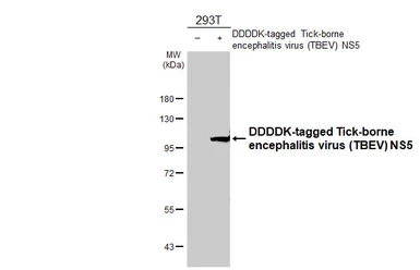 Anti-Tick-borne encephalitis virus (TBEV) NS5 antibody [HL4062] used in Western Blot (WB). GTX642477