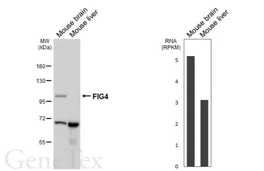 Anti-FIG4 antibody [GT149] used in Western Blot (WB). GTX642486