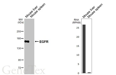 Anti-EGFR antibody [HL1097] used in Western Blot (WB). GTX642543