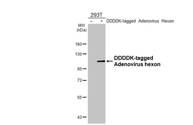 Anti-Adenovirus hexon antibody [HL4129] used in Western Blot (WB). GTX642575