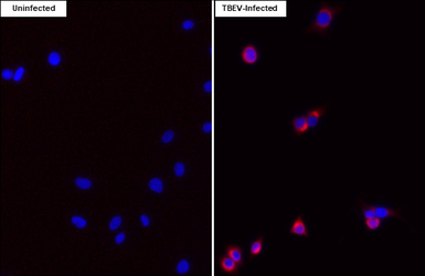 Anti-Tick-borne encephalitis virus (TBEV) NS2B antibody [HL4147] used in Immunocytochemistry/ Immunofluorescence (ICC/IF). GTX642952
