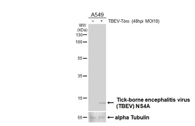 Anti-Tick-borne encephalitis virus (TBEV) NS4A antibody [HL4155] used in Western Blot (WB). GTX642960